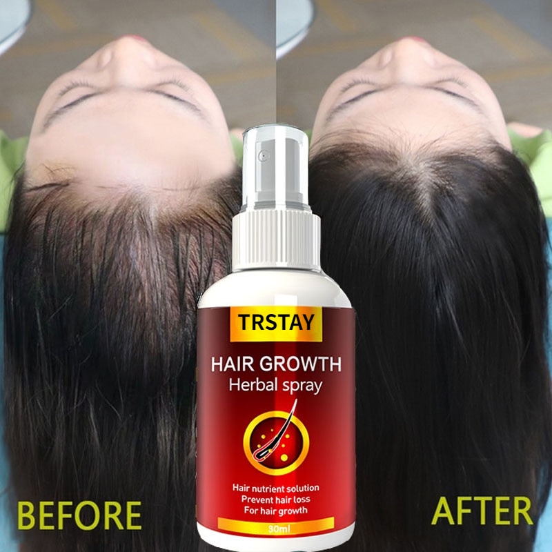 Hair Growth Serum Spray Fast Hair Growth